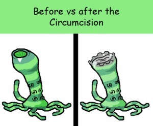 450px-Circum.png
